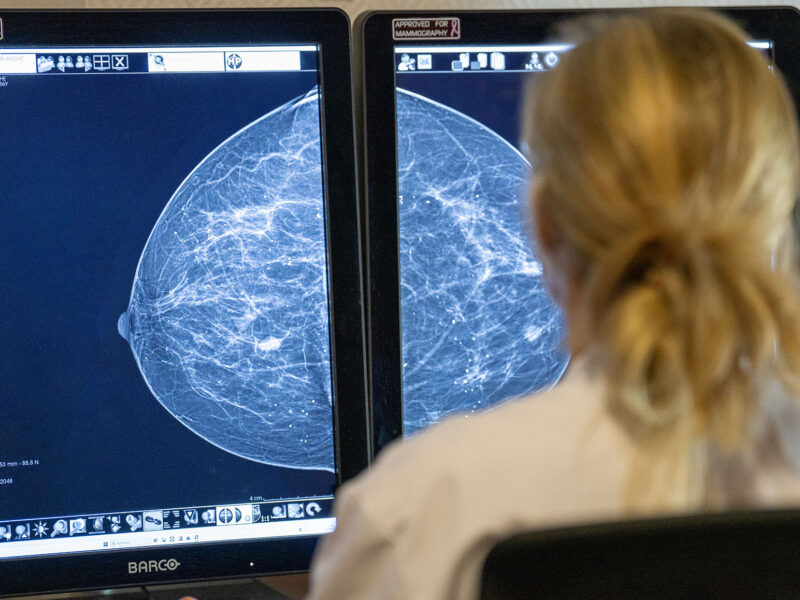 centre-soin-cancer-sein-bordeaux-1