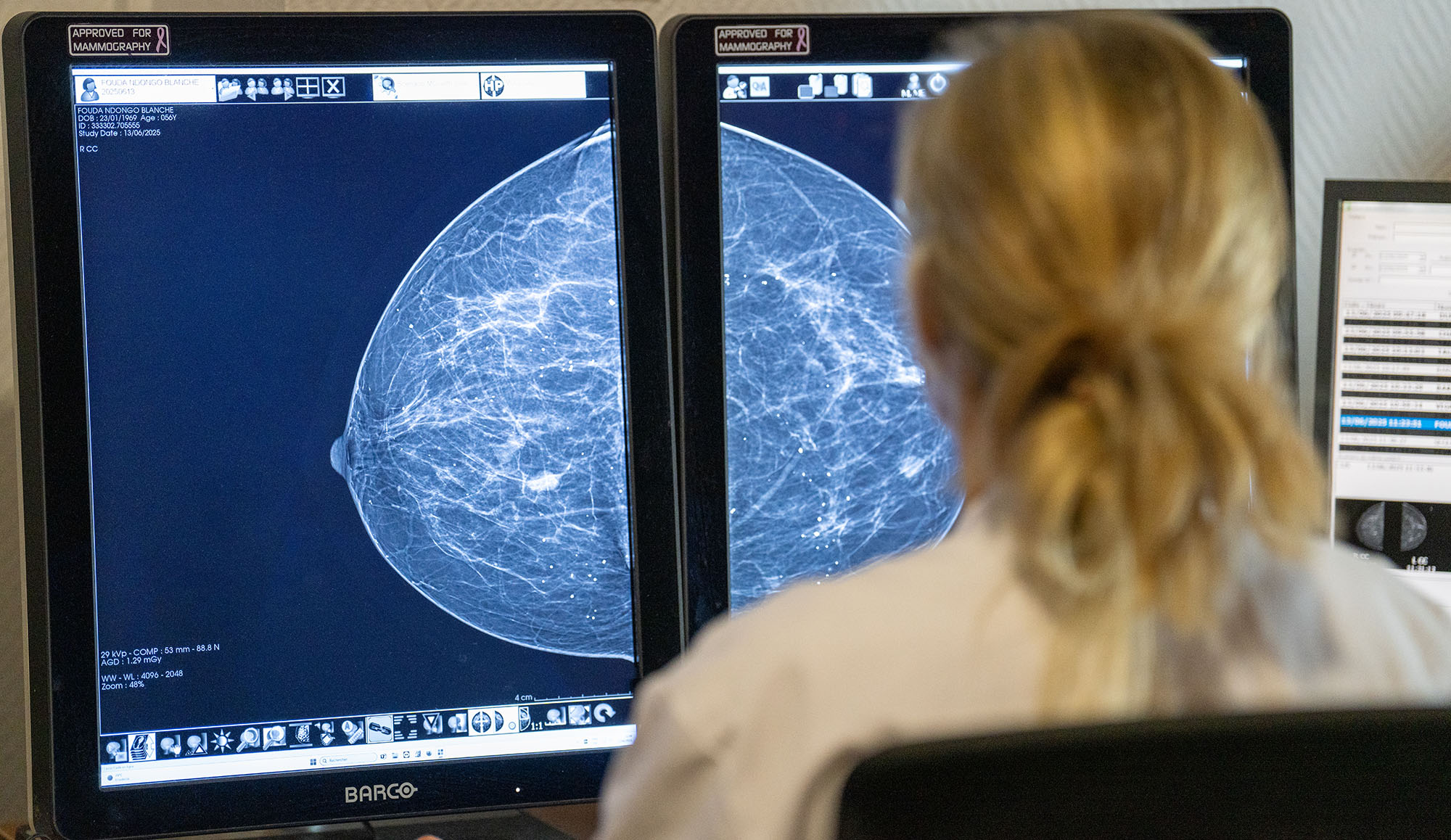 centre-soin-cancer-sein-bordeaux-1